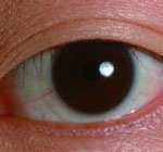 Schwarze Augen